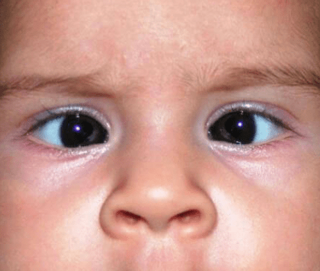 dr manpreet global eye hospital