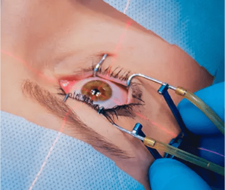 dr manpreet global eye hospital