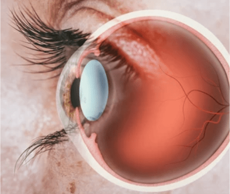 dr manpreet global eye hospital