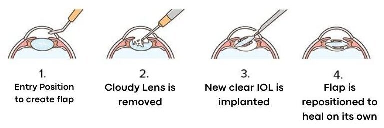 dr manpreet global eye hospital