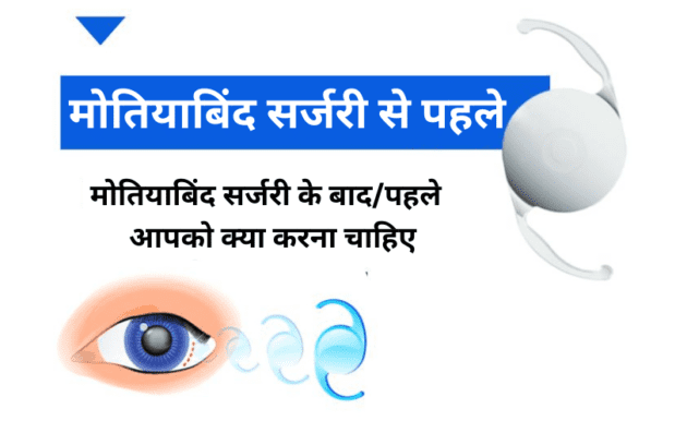 मोतियाबिंद