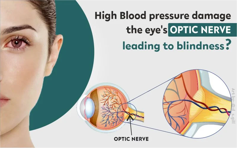 dr manpreet global eye hospital